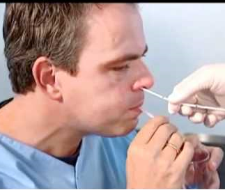 Naso Gastric tube placement