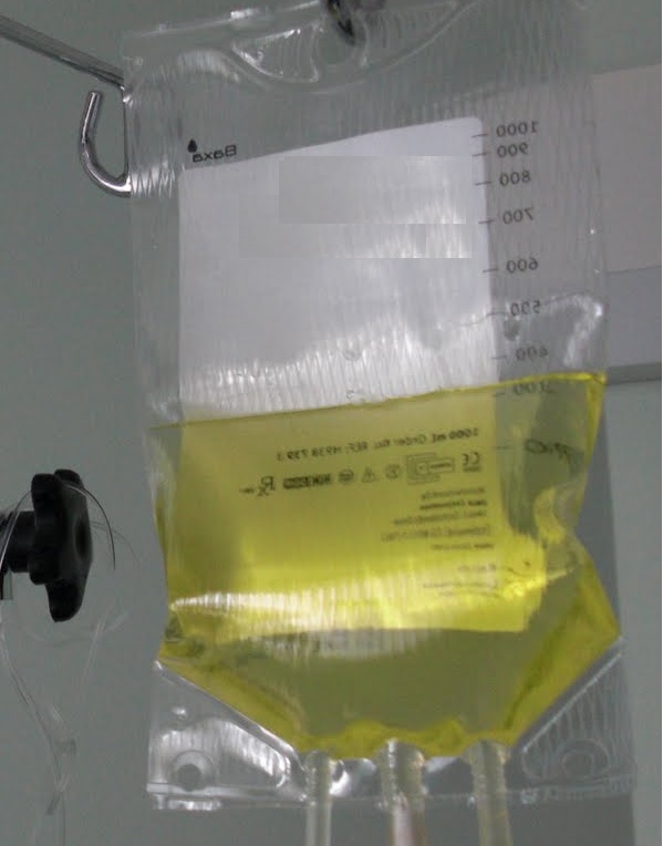 Home parenteral nutrition survey